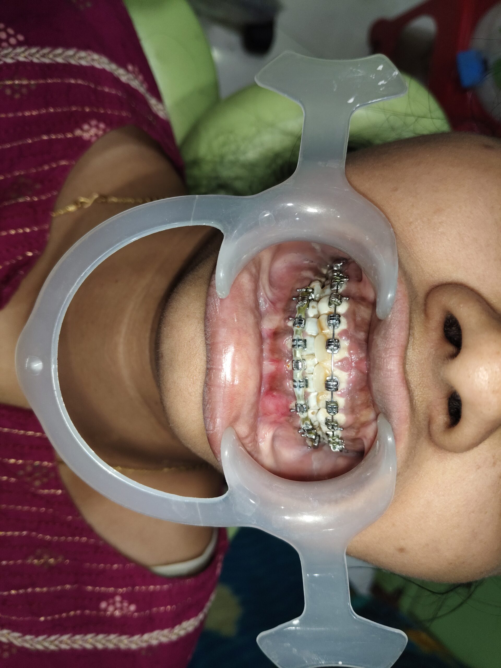 Home 27 filter: 0; fileterIntensity: 0.0; filterMask: 0; brp_mask:0;
brp_del_th:null;
brp_del_sen:null;
delta:null;
module: photo;hw-remosaic: false;touch: (-1.0, -1.0);sceneMode: 8;cct_value: 0;AI_Scene: (-1, -1);aec_lux: 0.0;aec_lux_index: 0;HdrStatus: auto;albedo: ;confidence: ;motionLevel: -1;weatherinfo: null;temperature: 34;