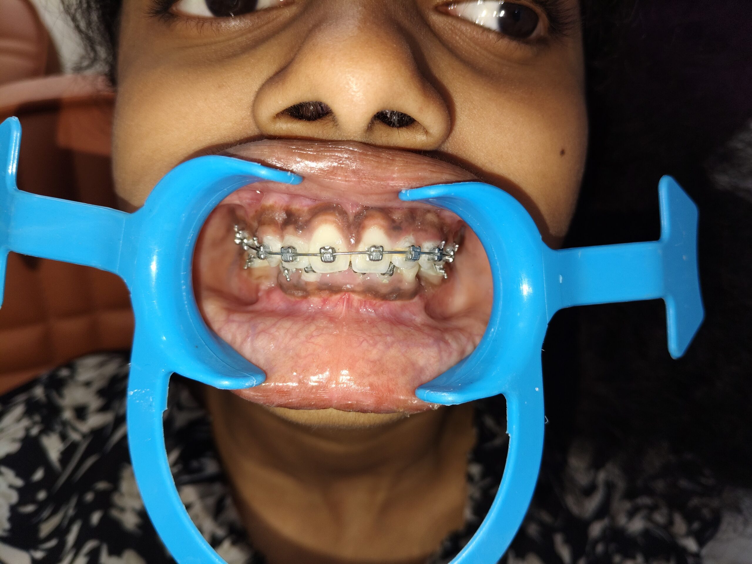 Home 25 filter: 0; fileterIntensity: 0.0; filterMask: 0; brp_mask:0;
brp_del_th:null;
brp_del_sen:null;
delta:null;
module: photo;hw-remosaic: false;touch: (-1.0, -1.0);sceneMode: 8;cct_value: 0;AI_Scene: (-1, -1);aec_lux: 0.0;aec_lux_index: 0;HdrStatus: off;albedo: ;confidence: ;motionLevel: -1;weatherinfo: null;temperature: 37;