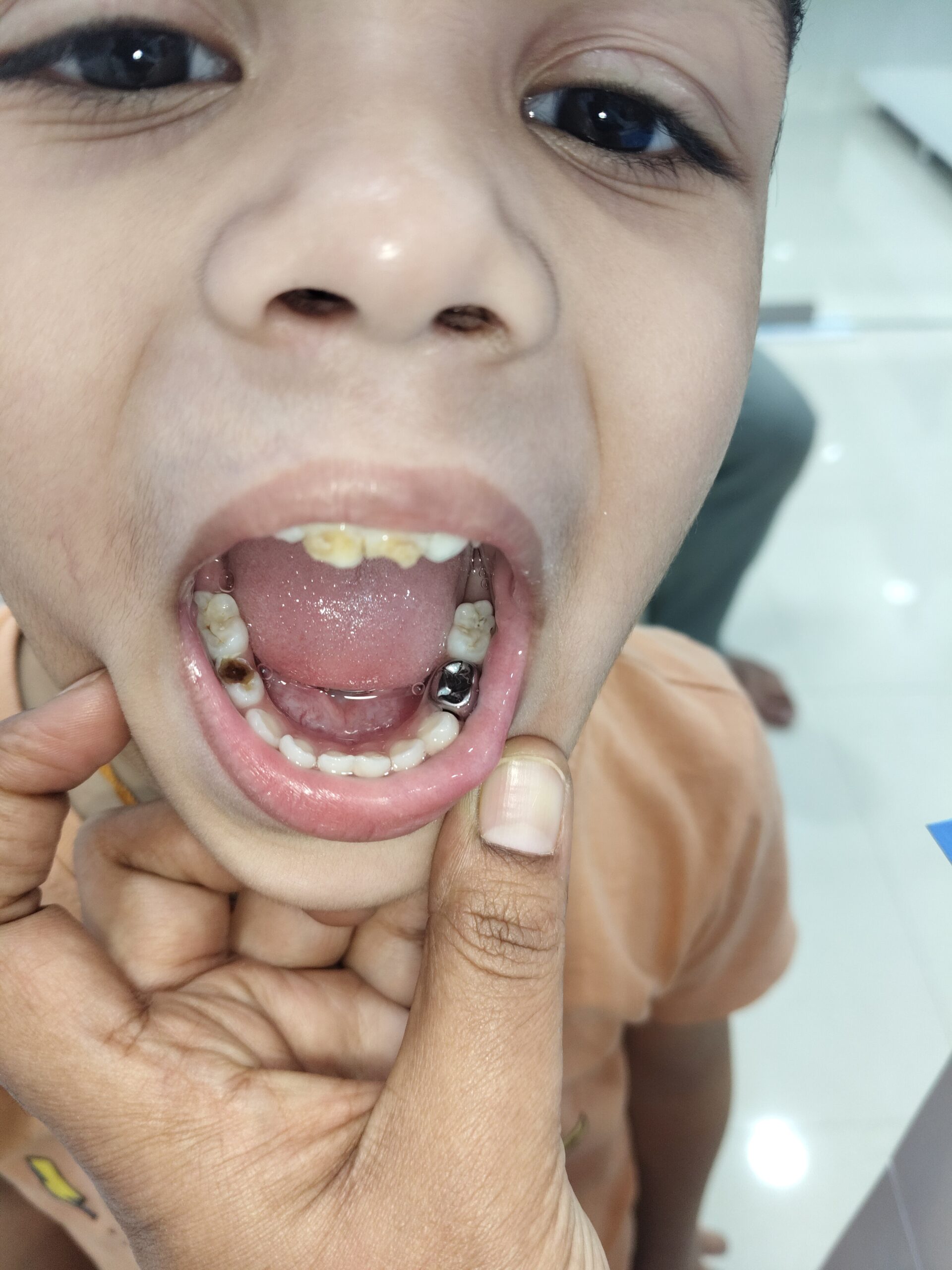 Home 23 filter: 0; fileterIntensity: 0.0; filterMask: 0; brp_mask:0;
brp_del_th:null;
brp_del_sen:null;
delta:null;
module: photo;hw-remosaic: false;touch: (0.022222223, 0.01875);sceneMode: 8;cct_value: 0;AI_Scene: (-1, -1);aec_lux: 0.0;aec_lux_index: 0;HdrStatus: auto;albedo: ;confidence: ;motionLevel: -1;weatherinfo: null;temperature: 32;