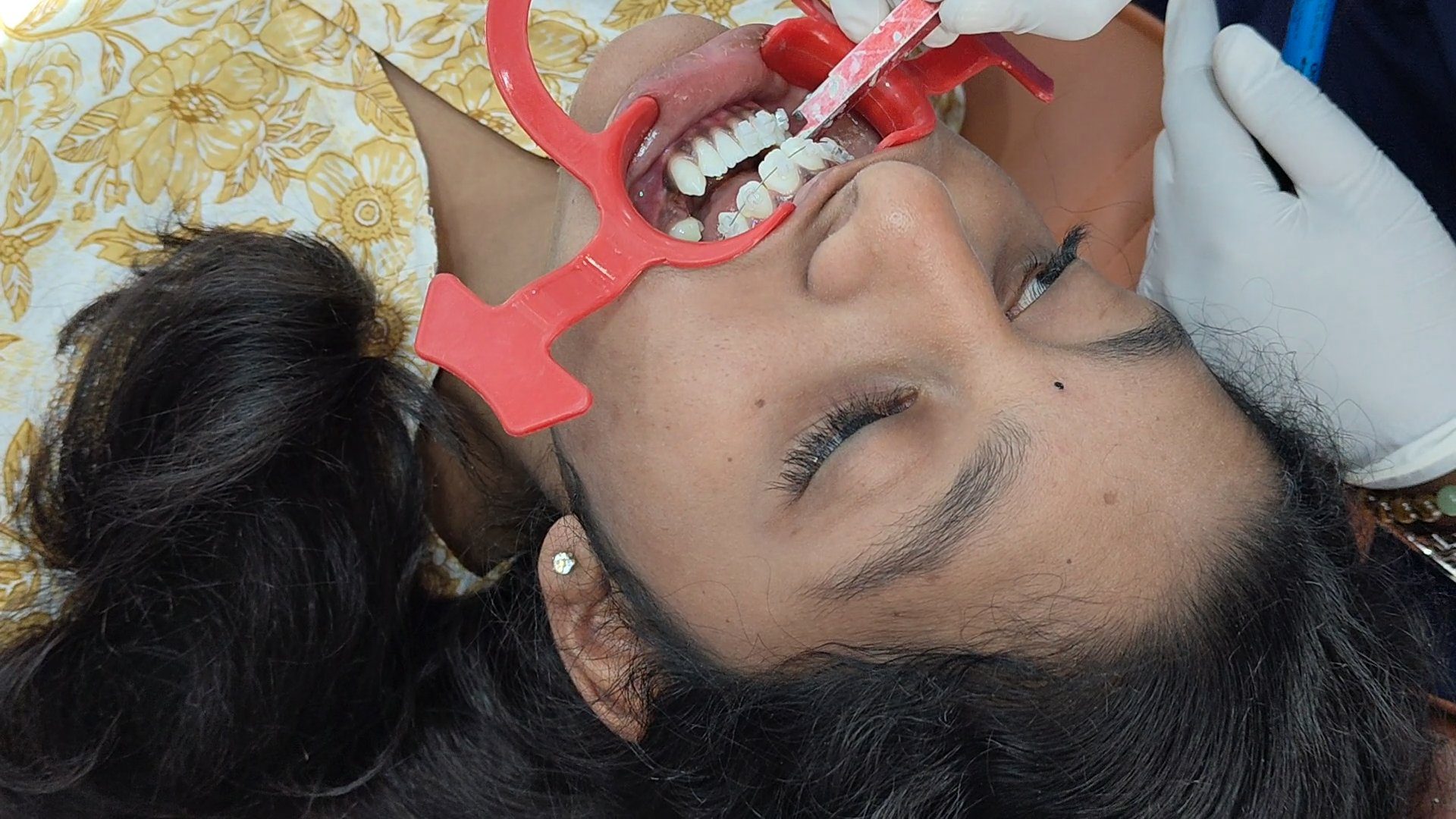 Home 35 video_20260123_162407_frame_0_12_17f