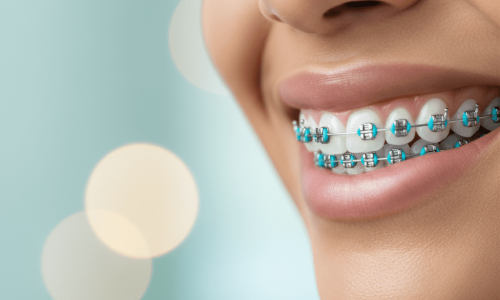 Gemini_Generated_Image_nse164nse164nse1 (1)